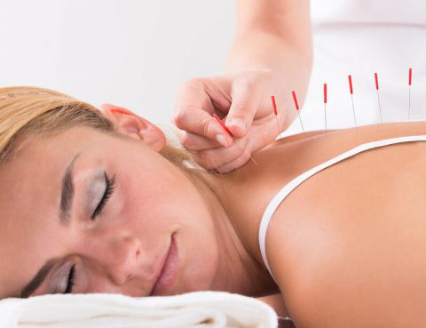 acupuncture for pain and stress in Lake Forest
