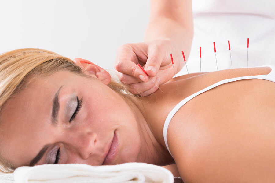 acupuncture for pain and stress in Lake Forest