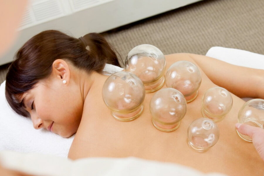 cupping therapy service treatment